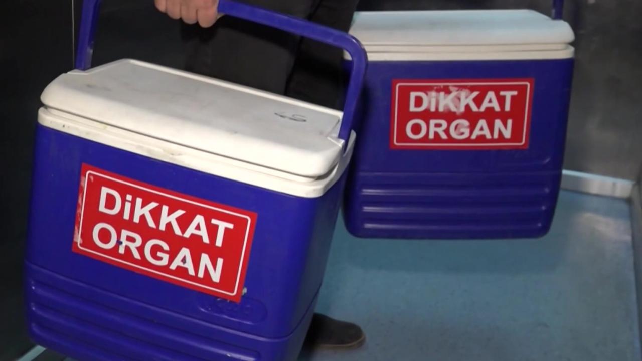 organ-nakli-1946247.jpg